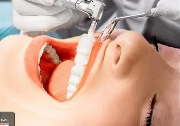 Профессиональная гигиена полости рта, включая удаление зубного камня с последующей полировкой