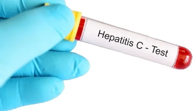 Определение антител к антигенам Hepatitis C virus (скрининг+тест)