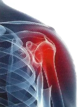 Рентгенография плечевого сустава (в прямой проекции)