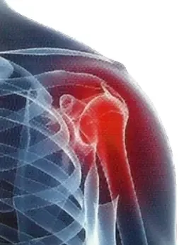 Фото для Рентгенография плечевого сустава (в прямой проекции)