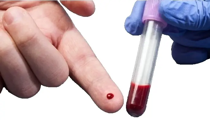Анализ крови на газовый состав (КЩС)