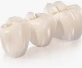 Протезирование зубов. Пластмассовая коронка.