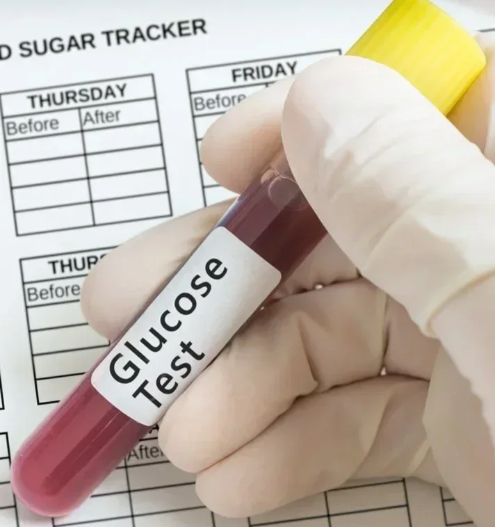 Глюкоза в крови (Glucose)