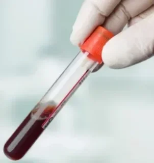Анализ крови на Пролактин